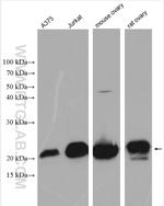 UBE2F Antibody in Western Blot (WB)