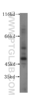 TEKT4 Antibody in Western Blot (WB)