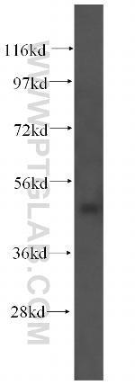 TEKT4 Antibody in Western Blot (WB)