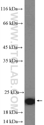 ARL8A Antibody in Western Blot (WB)