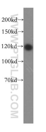 PMFBP1 Antibody in Western Blot (WB)