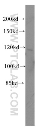 PMFBP1 Antibody in Western Blot (WB)