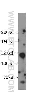 PMFBP1 Antibody in Western Blot (WB)
