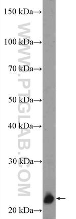 ZNF22 Antibody in Western Blot (WB)