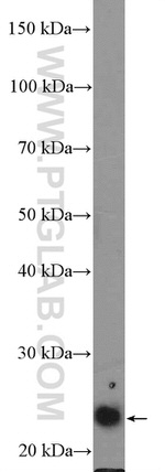 ZNF22 Antibody in Western Blot (WB)
