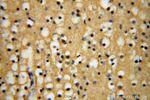 CALR3 Antibody in Immunohistochemistry (Paraffin) (IHC (P))