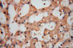 CALR3 Antibody in Immunohistochemistry (Paraffin) (IHC (P))