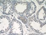 CALR3 Antibody in Immunohistochemistry (Paraffin) (IHC (P))