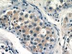 CALR3 Antibody in Immunohistochemistry (Paraffin) (IHC (P))