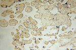SLFNL1 Antibody in Immunohistochemistry (Paraffin) (IHC (P))