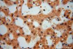 SLFNL1 Antibody in Immunohistochemistry (Paraffin) (IHC (P))