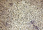 SLFNL1 Antibody in Immunohistochemistry (Paraffin) (IHC (P))