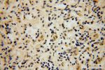 SLFNL1 Antibody in Immunohistochemistry (Paraffin) (IHC (P))