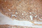 SLFNL1 Antibody in Immunohistochemistry (Paraffin) (IHC (P))