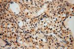SLFNL1 Antibody in Immunohistochemistry (Paraffin) (IHC (P))