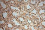 SLFNL1 Antibody in Immunohistochemistry (Paraffin) (IHC (P))