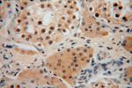 SLFNL1 Antibody in Immunohistochemistry (Paraffin) (IHC (P))