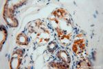 SLFNL1 Antibody in Immunohistochemistry (Paraffin) (IHC (P))