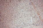 SLFNL1 Antibody in Immunohistochemistry (Paraffin) (IHC (P))