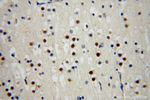 SLFNL1 Antibody in Immunohistochemistry (Paraffin) (IHC (P))