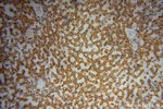 SLFNL1 Antibody in Immunohistochemistry (Paraffin) (IHC (P))