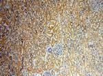 SLFNL1 Antibody in Immunohistochemistry (Paraffin) (IHC (P))