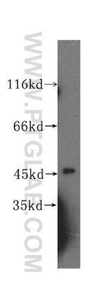 SLFNL1 Antibody in Western Blot (WB)