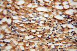 TEX12 Antibody in Immunohistochemistry (Paraffin) (IHC (P))