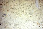 ZNF18 Antibody in Immunohistochemistry (Paraffin) (IHC (P))