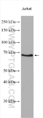 ZNF18 Antibody in Western Blot (WB)