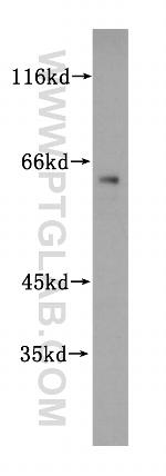 ZNF18 Antibody in Western Blot (WB)