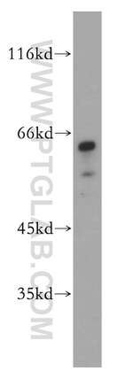 ZNF18 Antibody in Western Blot (WB)