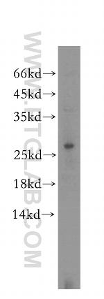 DNAJB8 Antibody in Western Blot (WB)