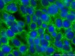 KATNAL2 Antibody in Immunocytochemistry (ICC/IF)