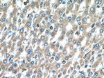 PIP4K2C Antibody in Immunohistochemistry (Paraffin) (IHC (P))