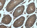 TBC1D5 Antibody in Immunohistochemistry (Paraffin) (IHC (P))