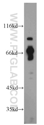 TBC1D5 Antibody in Western Blot (WB)