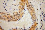 PDLIM7 Antibody in Immunohistochemistry (Paraffin) (IHC (P))
