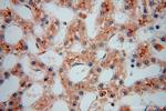 PDLIM7 Antibody in Immunohistochemistry (Paraffin) (IHC (P))