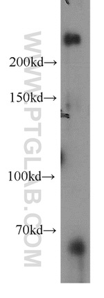 RAI1 Antibody in Western Blot (WB)
