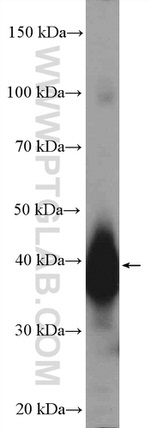 LUC7L Antibody in Western Blot (WB)