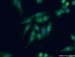 DDX27 Antibody in Immunocytochemistry (ICC/IF)