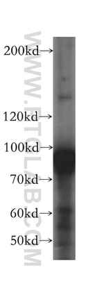 DDX27 Antibody in Western Blot (WB)