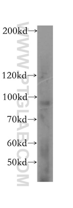 DDX27 Antibody in Western Blot (WB)