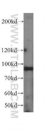 DDX27 Antibody in Western Blot (WB)