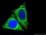MFF Antibody in Immunocytochemistry (ICC/IF)