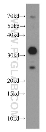 MFF Antibody in Western Blot (WB)
