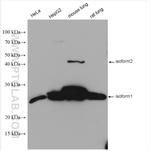 METTL7A Antibody in Western Blot (WB)