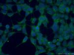 SPHK2 Antibody in Immunocytochemistry (ICC/IF)