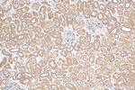 SPHK2 Antibody in Immunohistochemistry (Paraffin) (IHC (P))